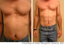 Six Pack